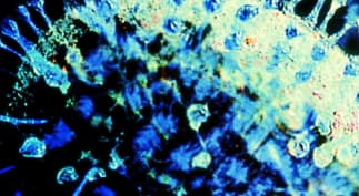 IMMUNEFOLD ANTIBODY