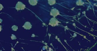 DEEPVISCOSITY